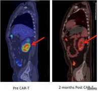 <b>改变免疫细胞的基因沐鸣平台登录线路以对抗癌症的可能性和风</b>