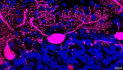 <b>代理沐鸣好吗破损的运输系统联合了神经退行性疾病</b>